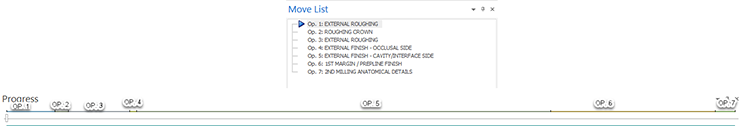 ProgressBar