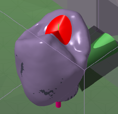CylinderCap